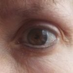 Image of an eye
